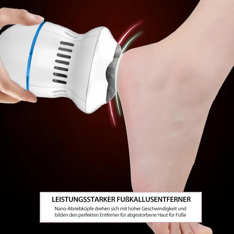 Nettjade™Elektrischer Hornhautentferner für Füße und Hände