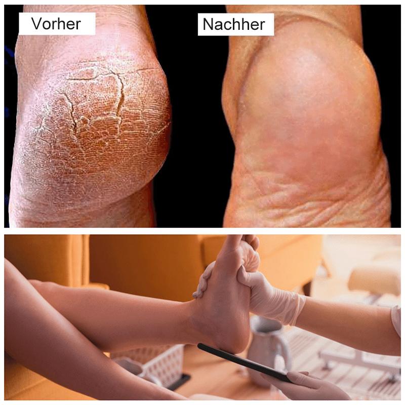 Nettjade™ Pediküre Fußfeile