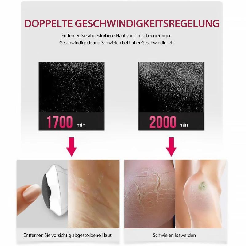 Nettjade™Elektrischer Hornhautentferner für Füße und Hände