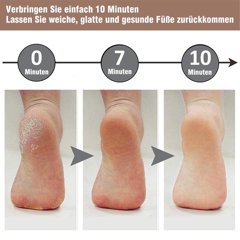 Nettjade™ Pediküre Fußfeile